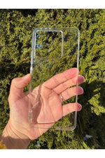Load image into Gallery viewer, Xiaomi Mi 14T Uyumlu Kılıf İnce Sert Sararmaz Kamera Kenarı Koruyucu Dayanıklı Kapak